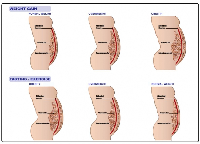 Abdominal Fat