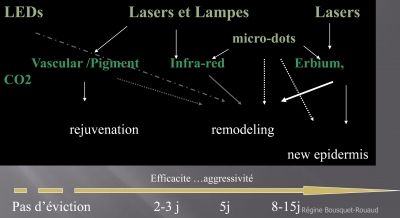 Combien de lasers pour traiter ?