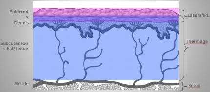 Deep Volumetric Heating