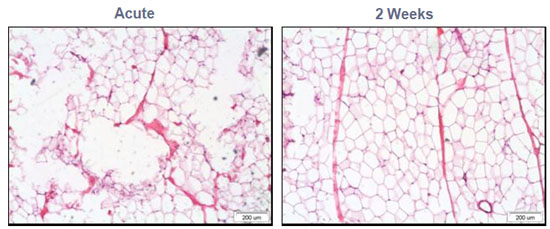 In-vivo Porcine Model: Acute and 2 Week Micro Effects
