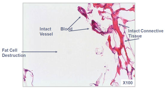 In-vivo Porcine Model: Acute Micro Effects