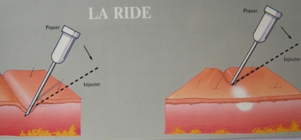 La ride