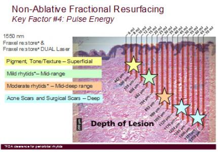 La technique fractionnée non ablative