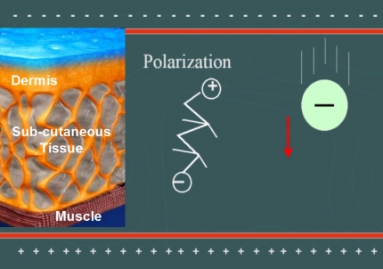 Monopolar Radiofrequency