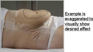 Patient Taping