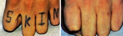 Tatouages : avant / après
