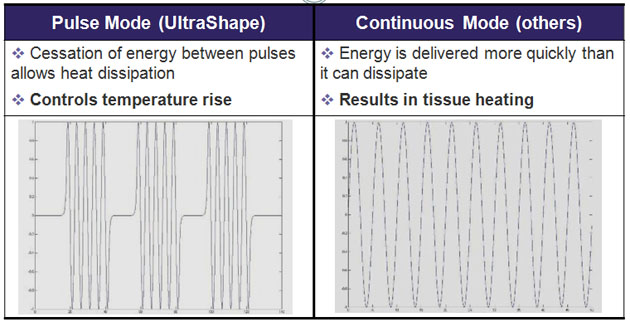 The UltraShape® Technology